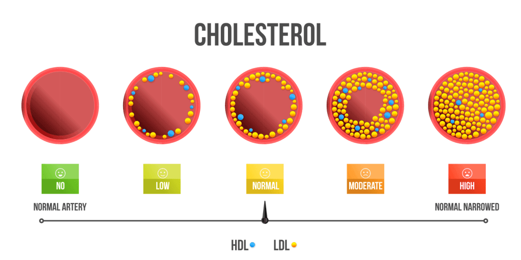 atorvastatin versus simvastatin